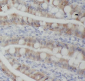 CD1D Mouse Monoclonal Antibody
