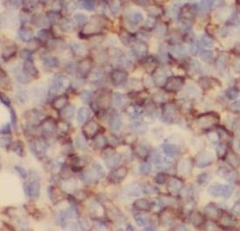 MS4A1 Rabbit Polyclonal Antibody