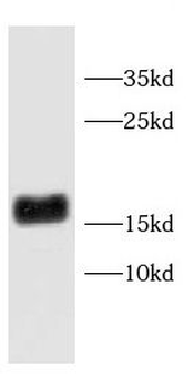 CD247 Rabbit Polyclonal Antibody