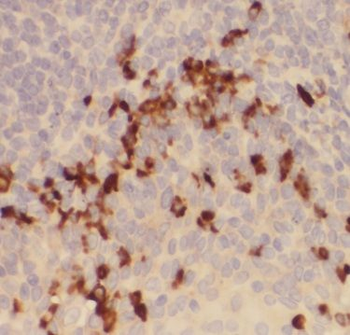 CD247 Rabbit Polyclonal Antibody