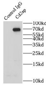 CD2AP Rabbit Polyclonal Antibody