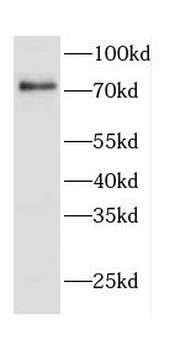 CD2AP Rabbit Polyclonal Antibody