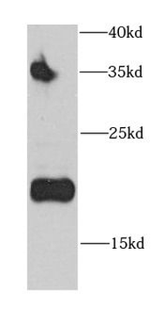CD3D Rabbit Polyclonal Antibody