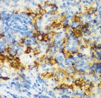 CD3D Rabbit Polyclonal Antibody