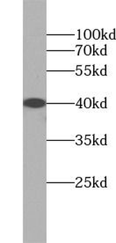CD38 Rabbit Polyclonal Antibody
