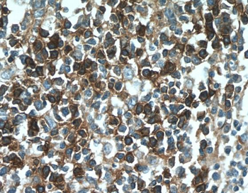 CD38 Rabbit Polyclonal Antibody