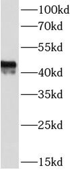 CD38 Mouse Monoclonal Antibody