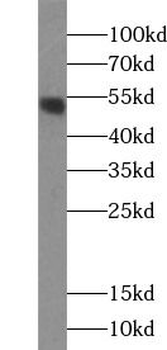 CD47 Rabbit Polyclonal Antibody