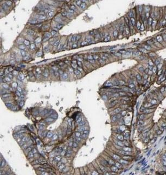 CD47 Rabbit Polyclonal Antibody
