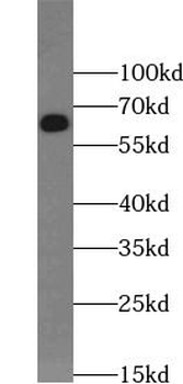 CD5 Rabbit Polyclonal Antibody