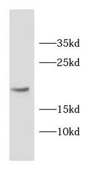 CD59 Rabbit Polyclonal Antibody