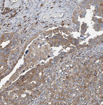 CD59 Rabbit Polyclonal Antibody