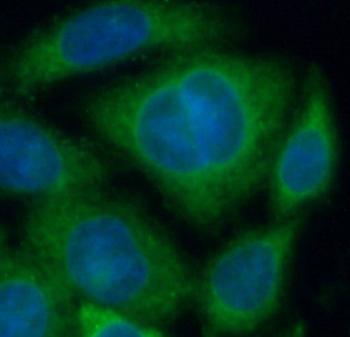 TFRC Mouse Monoclonal Antibody