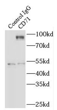 TFRC Mouse Monoclonal Antibody