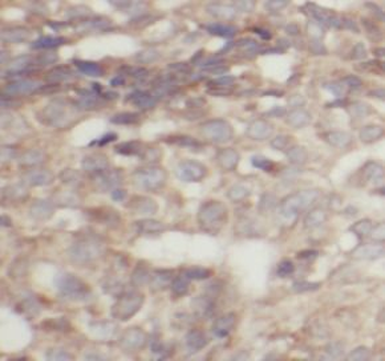 TFRC Mouse Monoclonal Antibody