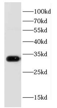 CD82 Rabbit Polyclonal Antibody