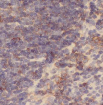 CD82 Rabbit Polyclonal Antibody