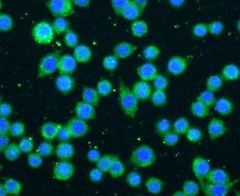 CD86 Rabbit Polyclonal Antibody