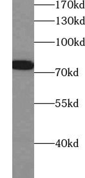 CD86 Rabbit Polyclonal Antibody