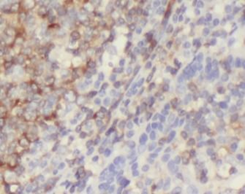CD86 Rabbit Polyclonal Antibody