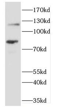 SLC3A2 Rabbit Polyclonal Antibody