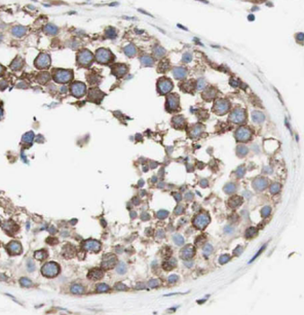 SLC3A2 Rabbit Polyclonal Antibody