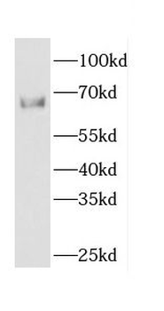 CDC14A Rabbit Polyclonal Antibody