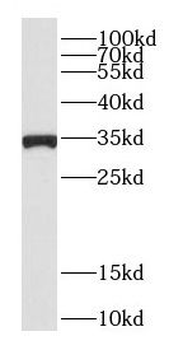 CDC34 Rabbit Polyclonal Antibody