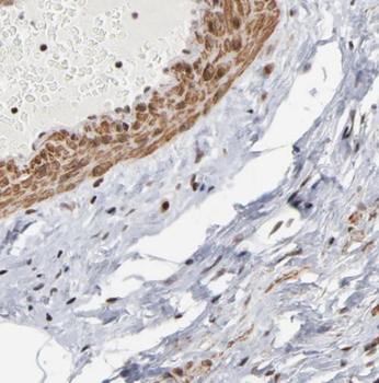 CDC34 Rabbit Polyclonal Antibody