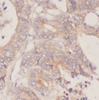 CDC37 Rabbit Polyclonal Antibody