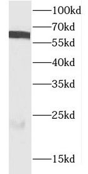 CDC6 Rabbit Polyclonal Antibody