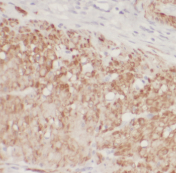 CDC6 Rabbit Polyclonal Antibody