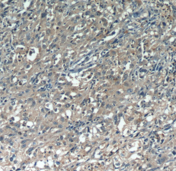 CDCA3 Rabbit Polyclonal Antibody