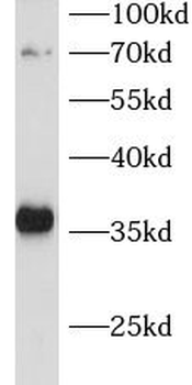 CDCA5 Rabbit Polyclonal Antibody