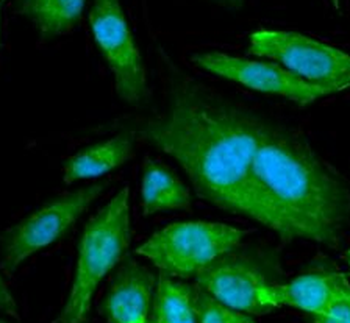 CDK6 Rabbit Polyclonal Antibody