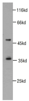 CDK6 Rabbit Polyclonal Antibody