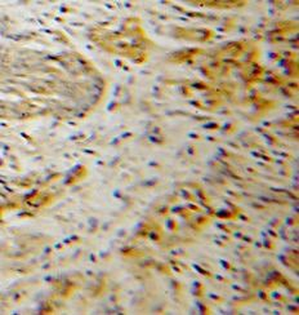 CDK6 Rabbit Polyclonal Antibody