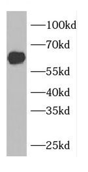 CDKAL1 Rabbit Polyclonal Antibody