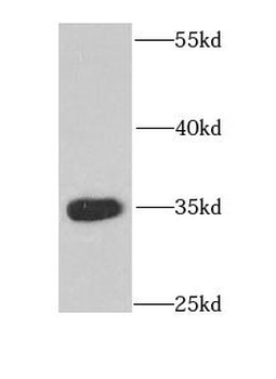 CDX1 Rabbit Polyclonal Antibody