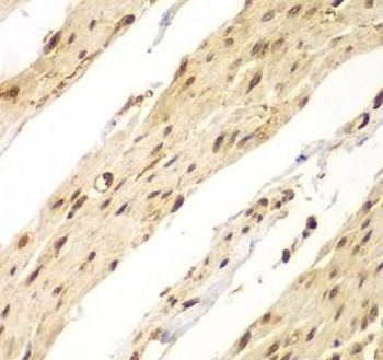 CDX1 Rabbit Polyclonal Antibody