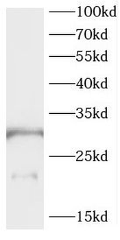 CEACAM21 Rabbit Polyclonal Antibody