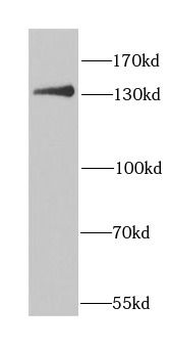 CENPC Rabbit Polyclonal Antibody