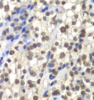 CENPC Rabbit Polyclonal Antibody