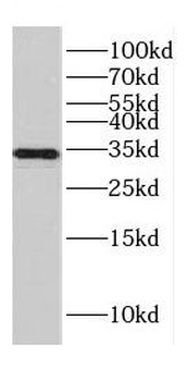 CENPO Rabbit Polyclonal Antibody
