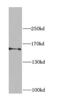 CEP164 Rabbit Polyclonal Antibody