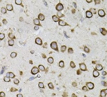CEP164 Rabbit Polyclonal Antibody