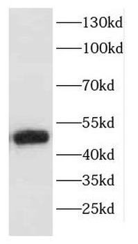 CFP Rabbit Polyclonal Antibody