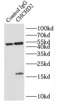 CHCHD2 Rabbit Polyclonal Antibody