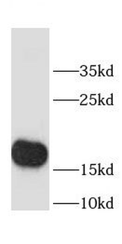 CHCHD2 Rabbit Polyclonal Antibody