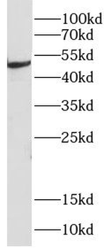 CHDH Rabbit Polyclonal Antibody